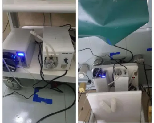 Bơm nhu động xối rửa nội soi